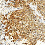 BAG2 Antibody in Immunohistochemistry (Paraffin) (IHC (P))