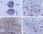BFAR Antibody in Immunohistochemistry (Paraffin) (IHC (P))