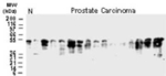 BFAR Antibody in Western Blot (WB)