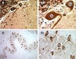 BFAR Antibody in Immunohistochemistry (Paraffin) (IHC (P))