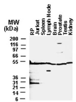 BFAR Antibody in Western Blot (WB)