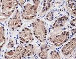 PTPN13 Antibody in Immunohistochemistry (Paraffin) (IHC (P))