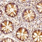 ZDHHC23 Antibody in Immunohistochemistry (Paraffin) (IHC (P))