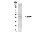 IL18BP Antibody in Western Blot (WB)