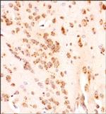 GLI1 Polyclonal Antibody
