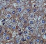 ENPP1 Polyclonal Antibody
