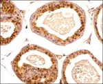 PPARGC1A Antibody in Immunohistochemistry (Paraffin) (IHC (P))