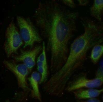 Pyruvate Carboxylase Polyclonal Antibody