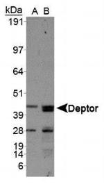DEPDC6 Antibody in Western Blot (WB)