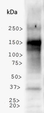 NBR1 Antibody in Western Blot (WB)