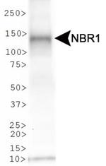NBR1 Antibody in Western Blot (WB)