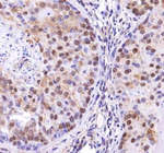 TP53INP2 Antibody in Immunohistochemistry (Paraffin) (IHC (P))