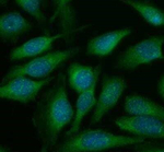 ATF6 Polyclonal Antibody