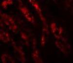 GLS2 Polyclonal Antibody