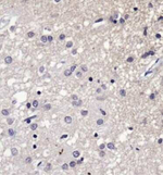 SERF1A Antibody in Immunohistochemistry (Paraffin) (IHC (P))