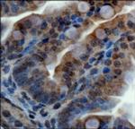 ZNF521 Antibody in Immunohistochemistry (Paraffin) (IHC (P))