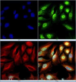 SETX Polyclonal Antibody