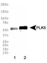 PLK5 Antibody in Western Blot (WB)
