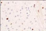PIF1 Polyclonal Antibody