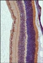 RP1 Antibody in Immunohistochemistry (Paraffin) (IHC (P))