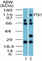 PTK7 Antibody in Western Blot (WB)