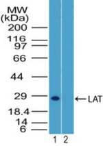 LAT Antibody in Western Blot (WB)