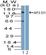 AP3D1 Antibody in Western Blot (WB)