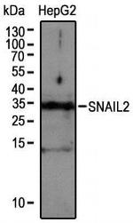 SLUG Antibody in Western Blot (WB)