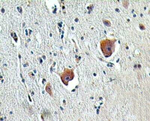 SHARPIN Polyclonal Antibody