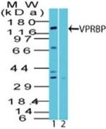 VPRBP Polyclonal Antibody