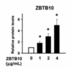 ZBTB46 Polyclonal Antibody