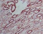 SAMHD1 Polyclonal Antibody