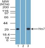 HES7 Polyclonal Antibody