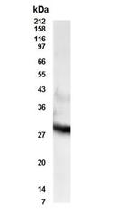 RDH11 Polyclonal Antibody