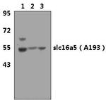 MCT5 Polyclonal Antibody