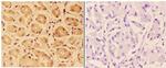 PTPRO Polyclonal Antibody