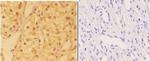 DHX36 Antibody in Immunohistochemistry (Paraffin) (IHC (P))