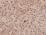 GLUT3 Antibody in Immunohistochemistry (Paraffin) (IHC (P))