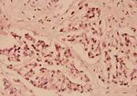 IkB epsilon Polyclonal Antibody