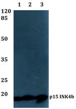 CDKN2B Antibody in Western Blot (WB)