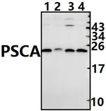 PSCA Polyclonal Antibody