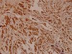 PCAF Polyclonal Antibody