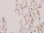 SENP5 Polyclonal Antibody