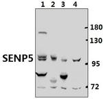 SENP5 Antibody in Western Blot (WB)