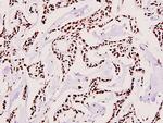 UBA2 Polyclonal Antibody