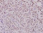 WAVE1 Antibody in Immunohistochemistry (Paraffin) (IHC (P))