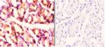 RAD52 Polyclonal Antibody