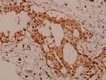 KSR1 Polyclonal Antibody