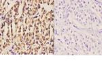 DGKI Polyclonal Antibody