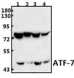 ATF7 Antibody in Western Blot (WB)